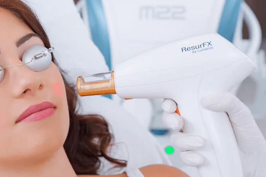 resurfx-skin-resurfacing-edmonton-ab-ca-64ef5eb024ad4